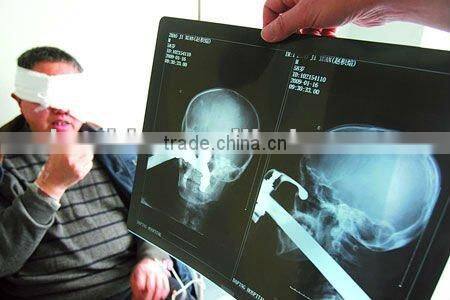 Konida Medical Dry Film, x ray film from manufacturer, KND-A/F