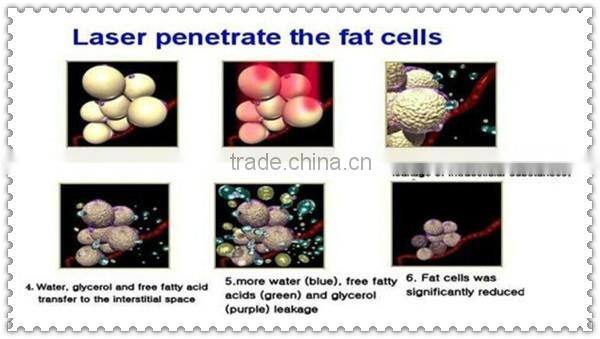 Lipo laser lipolysis slimming machine dm-909