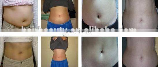 2016 hot product fat freeze criolipolisis professional/handle for criolipolisis