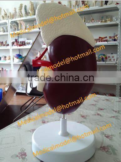 Kidney anatomical model