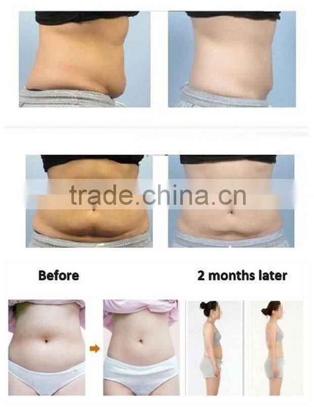 CE approved portable fat reduction machine radio frequency cavitation slimming machine