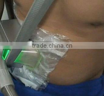 cryotherapy freezing machines-Antifreeze Membrane provide