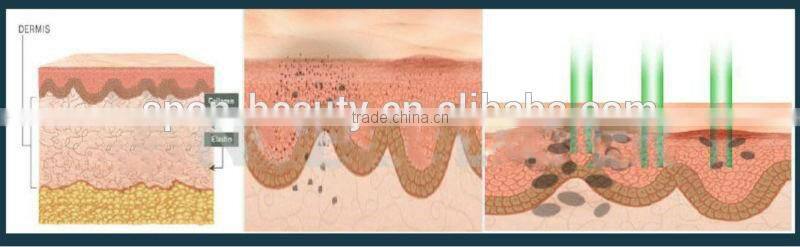 Hot selling Black baby laser cleaning machine