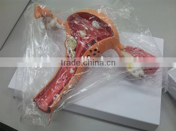 Enlarged atlas axial cervical thoracic and lumbar