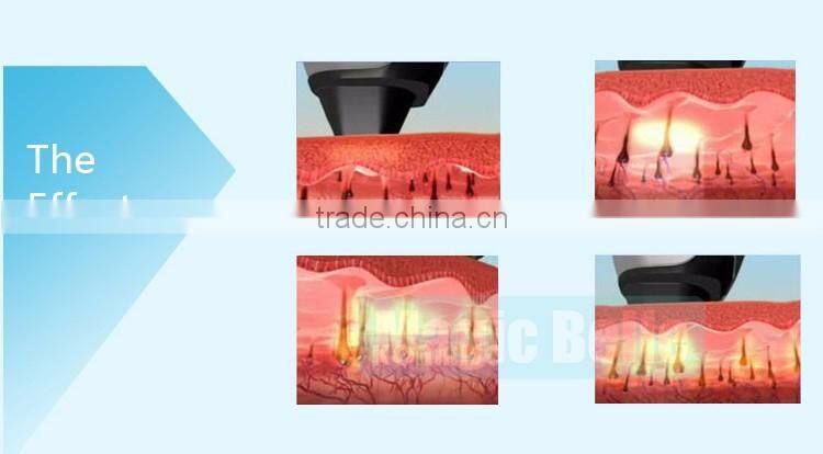 Permanent Hair Removal!!! Personal Use Hair Removal IPL Machine in China