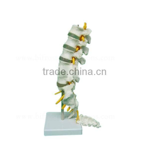 Life-size 5 Pcs Anatomical Lumbar Vertebra Model