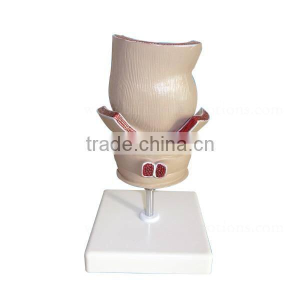 Rectum Pathology Organs Education Human Body Anatomy Model