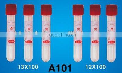 Sodium citrate tube 1:9
