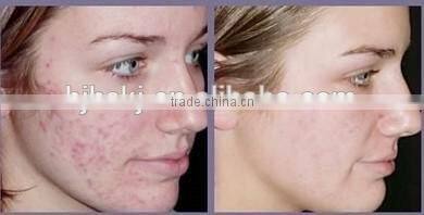 Promotion new technology Clinic use hair removal devices ipl/hair removal shr ipl