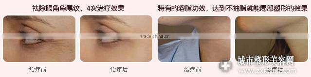 2013 newest eye care machine