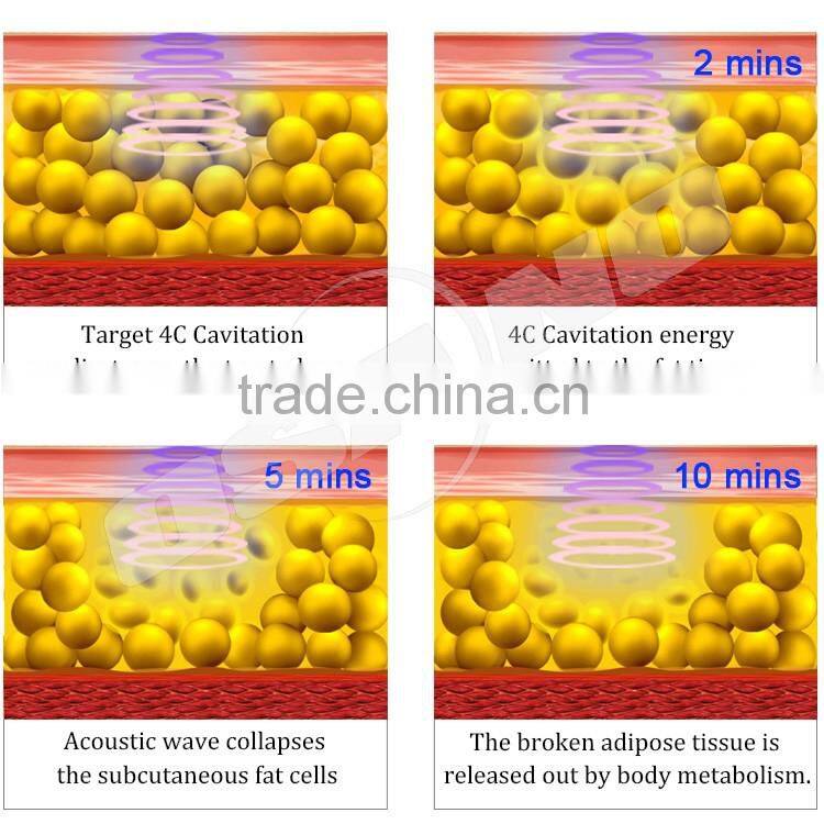 Ice Head & Ultrasonic & Vacuum Pressure Roller Massage & RF Blast Lipo Slimming Down Machine