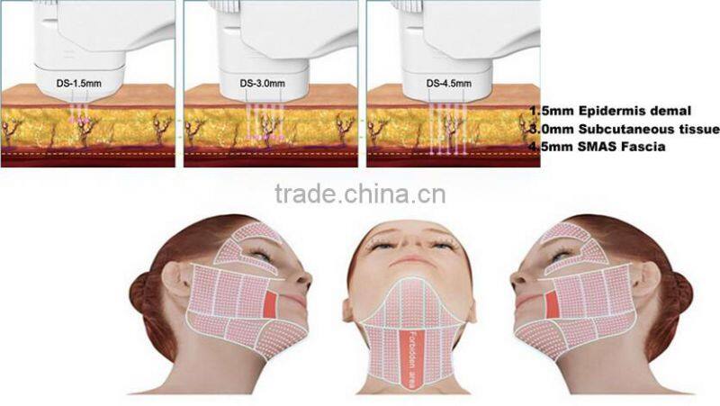 Best price Skin tightening hifu for wrinkle removal system / skin tightening machine