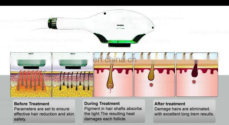 korea ipl machine shr e light machine ipl laser hair removal machine for sale