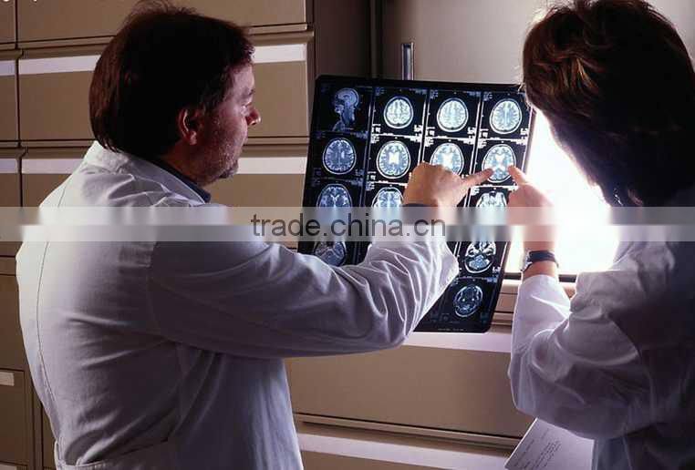 Konida dental hot sex 14*17 agfa medical filmagfa holder fuji dry film