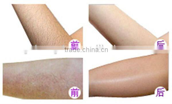 Permanent hair removal machines for skin rejuvenation beauty machine BD-J005