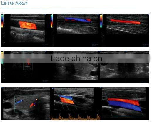 3D and 4D Color Doppler with 4D Real Time Live Probe iSpark 480plus/option Trans-vaginal Array Probe (180)