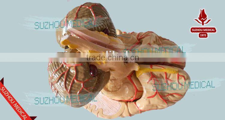 Distribution of brain and cerebral arteries