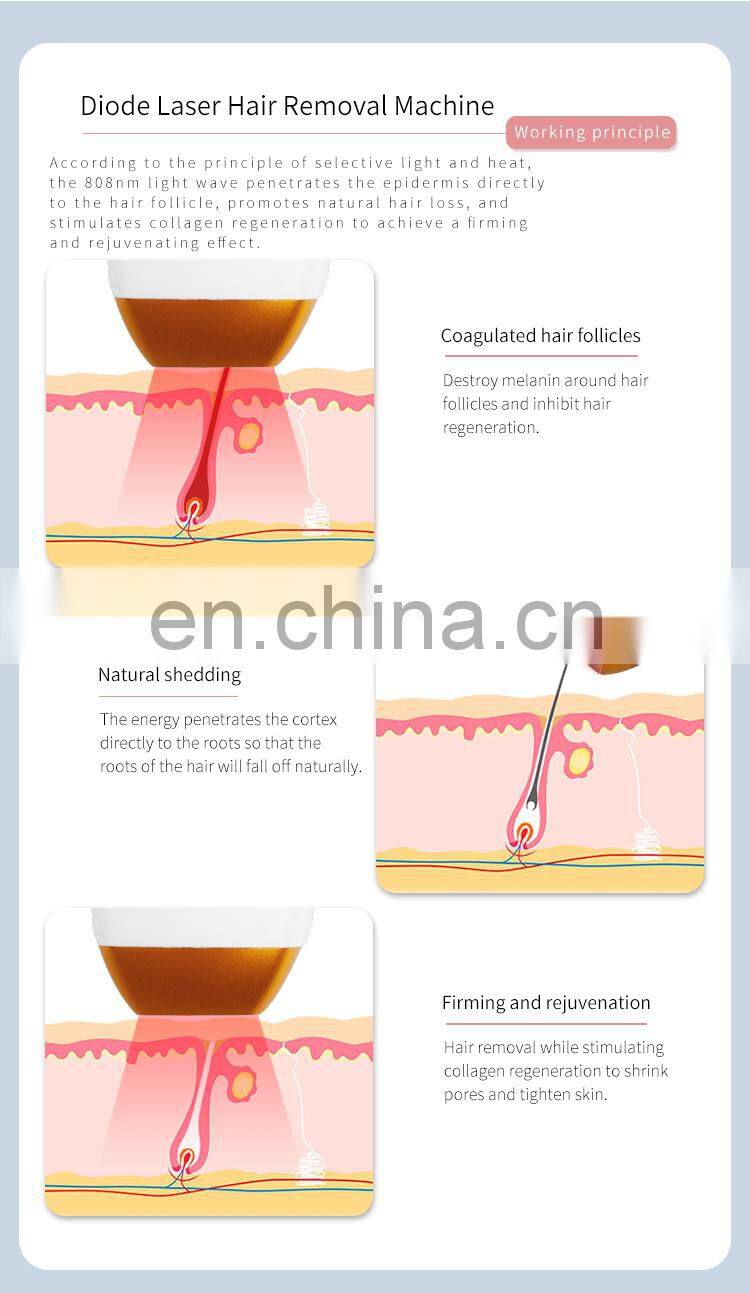 A-lma Laser So-prano Ice Titanium Diode Laser Hair Removal Machine Triple Wavelength 755 808 1064 Permanent Depilation Equipment