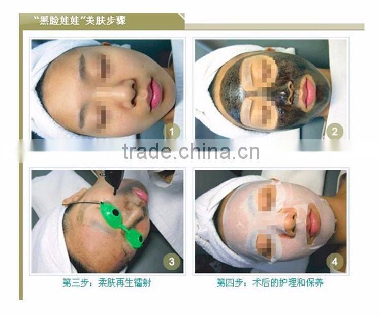 big sale laser tattoo removal machine active q switch nd yag laser tattoo removal pigment removal beauty equipment machine