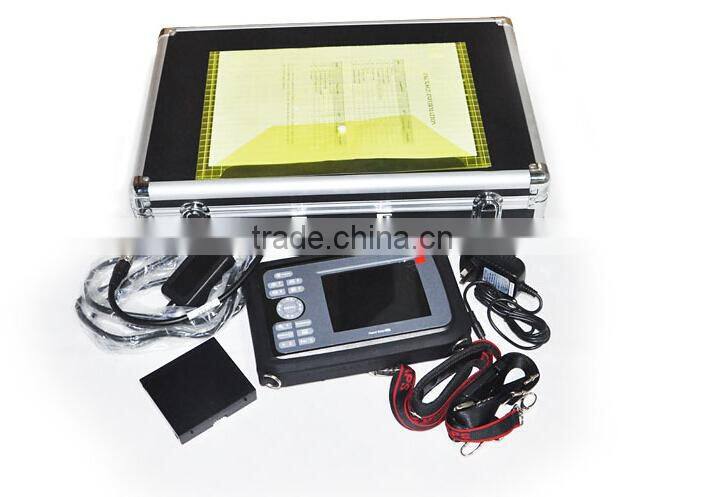 High quality CE approved Pocket ultrasound machine hand-held ultrasound scanner