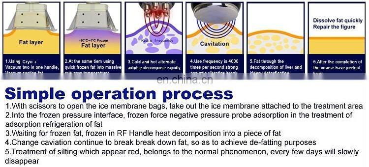 Cryolipolysis Machine For Home Use, Cryolipolyse Machine Portable