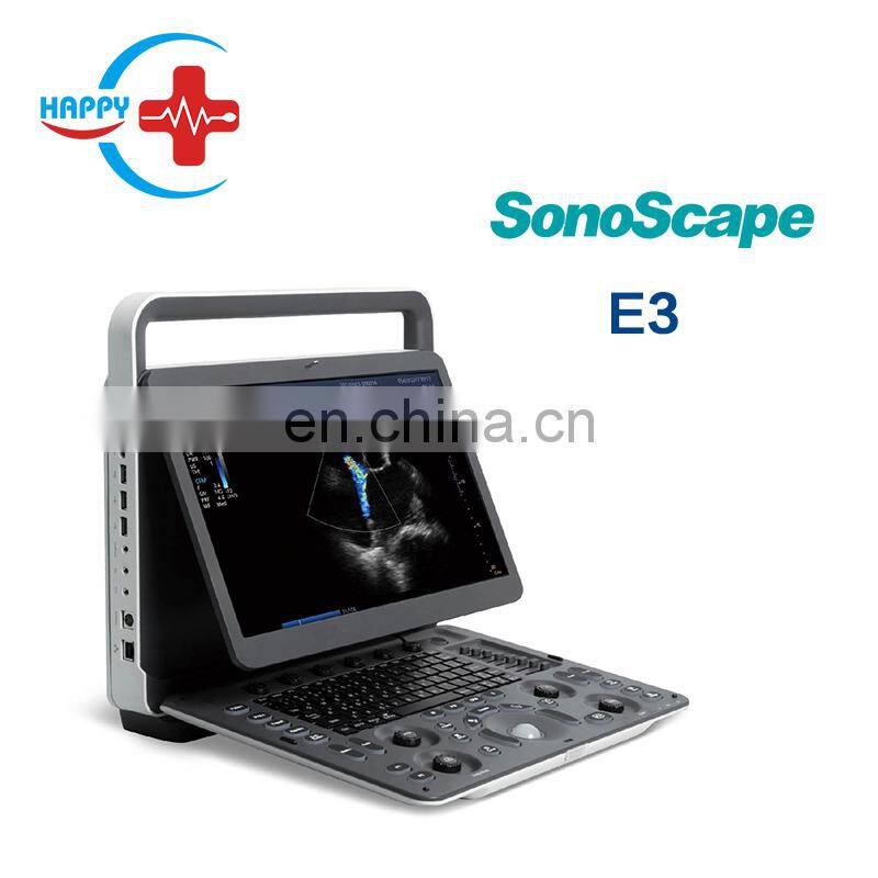 Hot Sale Sonoscape E3 Portable 15 Inch LCD Laptop Ultrasound Device Color Doppler Ultrasound Machine