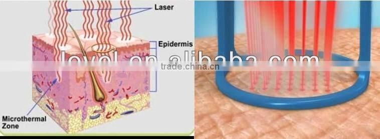 Professional Skin Resurfacing medical fractional co2 laser beauty machine