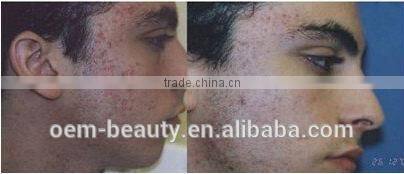Factory direct sales !! 808nm Diode Laser+IPL diode laser hair removal with CE approved