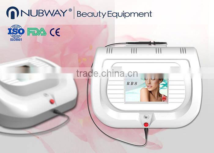30 mhz beauty spa use portable spider vein removal machine