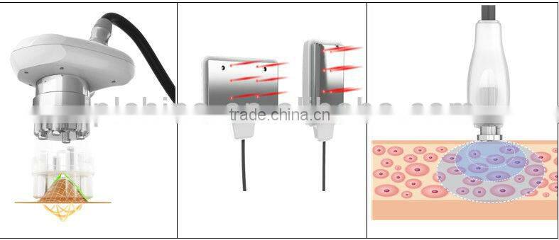 HOT ! Best Vacuum machine beauty Slimming Equipmen