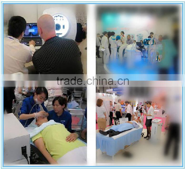 latest technology new design super hair removal machine ipl shr