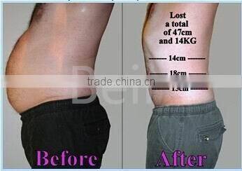 Three handles criolipolisis coolshape body slimming machine with CE ISO approved