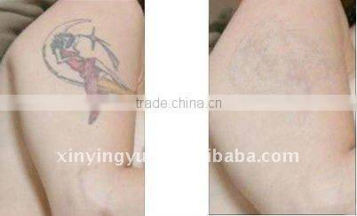Mini table Yag laser tattoo removal equipment