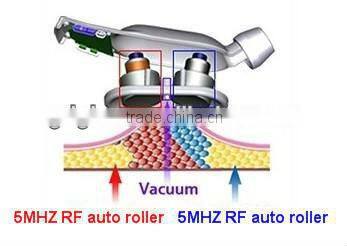Vacuum Cavitation System sixpolar rf /multipolar RF machine /RF slimming machine