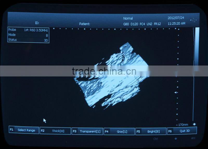 CE Mark Medical Equipment Portable ultrasonic/Cheapest ultrasounic Scanner/Machine 3.5Mhz multi-frequency Convex Probe-Shelly