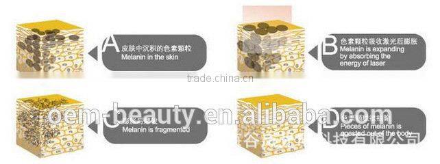 ce approved nd yag laser tattoo removal painless salon used machine with lowest price