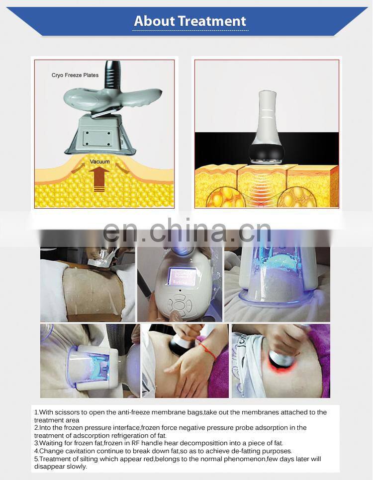 Factory price cryo 21 machine with double chin removal handles