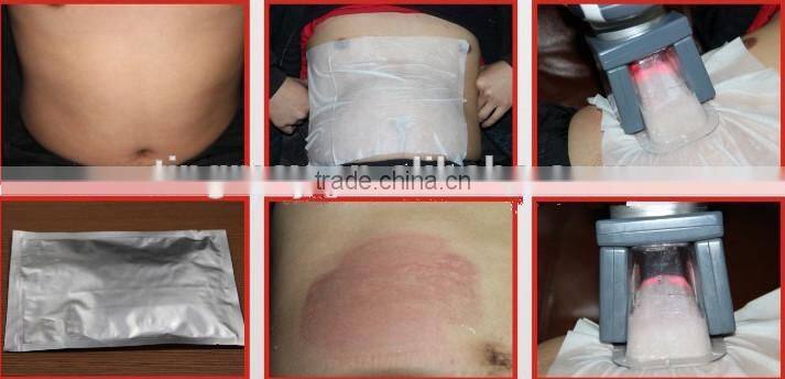 Portable cryo cavitation rf lipo laser cryolipolysis/cryolipolysis machine