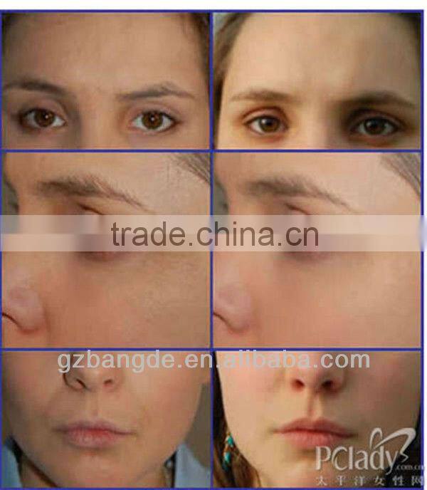 Face Massager Machine For Skin Tightening and Anti-aging BD-SP003