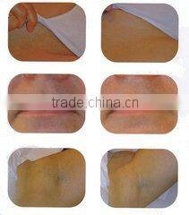 808 diode laser hair removal machine