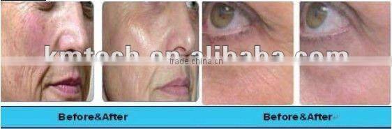 Professional cycling machine weight loss