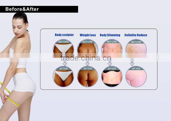 Radio Frequency Wrinkle Removal Vacuum Roller Fat Removal Device For Beauty Clinic