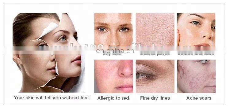 Factory aqua dermabrasion peel spa facial machine / water microdermabrasion facial machine /hydra dermabrasion beauty