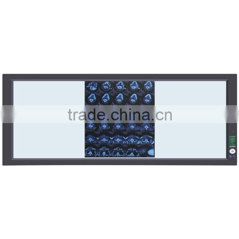 medical laboratory equipment x ray film viewer