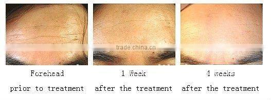 Handheld Massage Roller/Facial Beauty Roller L007