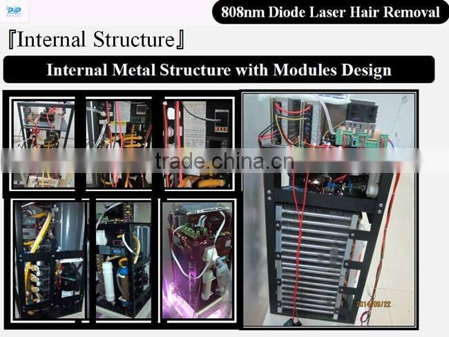 808nm Diode Laser machine for hair removal laser hair removal machine