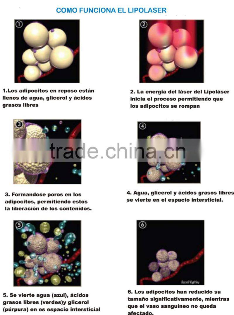 Wholesale Mini Lipo Laser Machine For Home Use