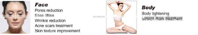 2015 Matrix Fractional Microneedle RF& microneedle Fractional RF for face lifting with CE, ISO