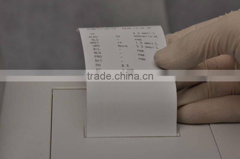 Auto Malfunction Detection Urine Analyzer