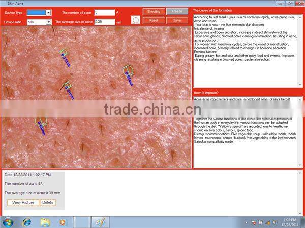 New Product Portable Facial Skin Analyzer Beauty Equipment
